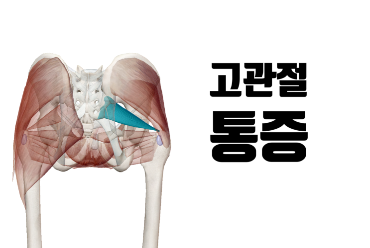 원인불명의 고관절 불편감, 통증[영통역 새움한의원]