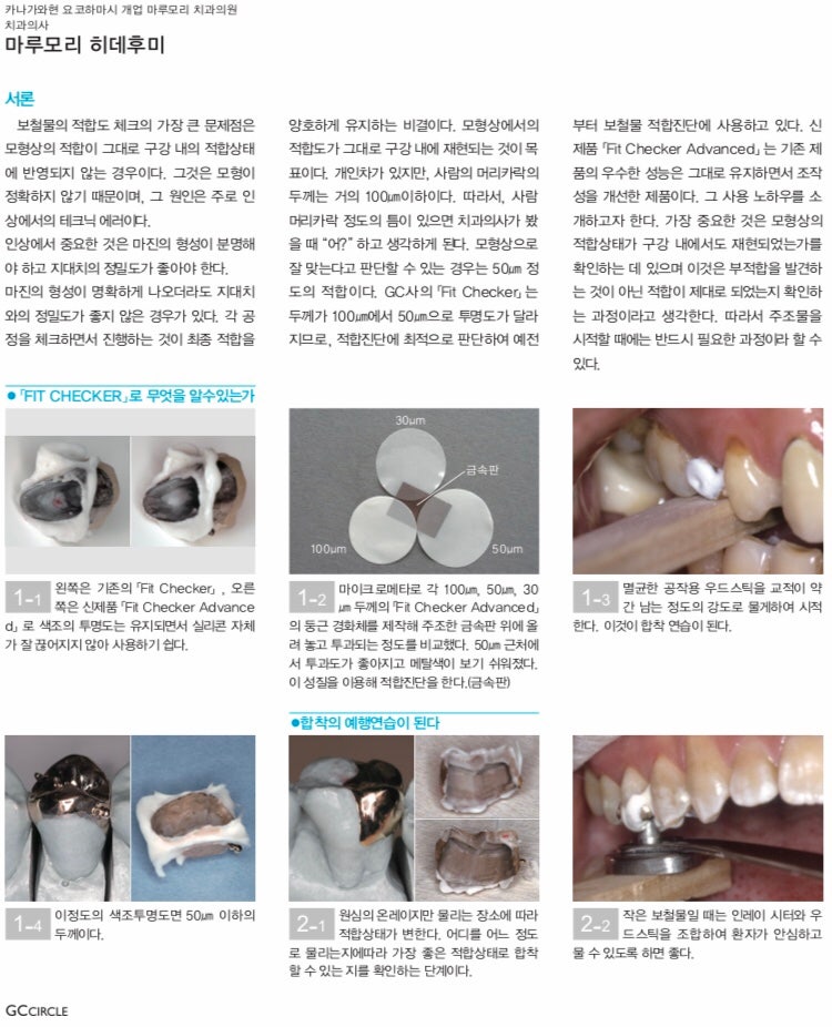 [박실장의정보마당]치과재료 핏체커(Fit Checker)란? 정의·사용 목적·사용 방법 총정리 : 네이버 블로그