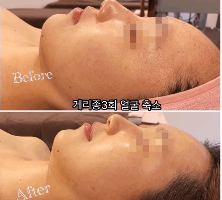  내 피부에 힐링을 선사하는 노형 뷰티샵 할인정보~!