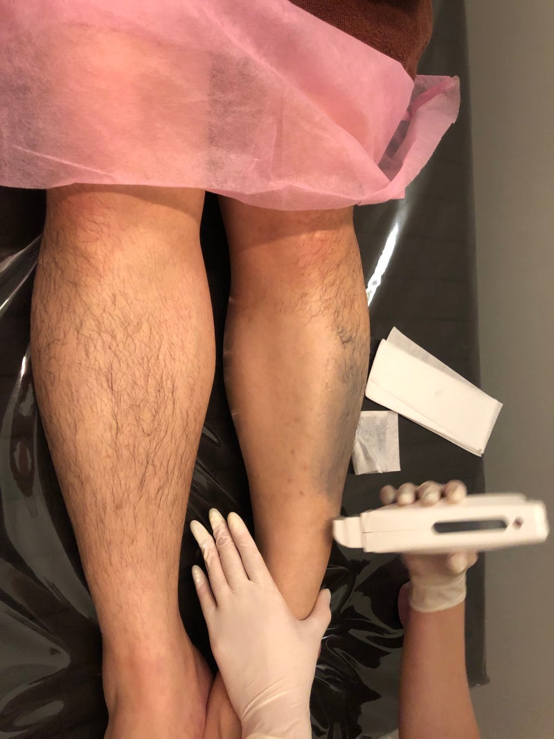 양산왁싱 남자 왁싱도 라트리네일 수지쌤 아프지않고 넘 잘하세요 : 네이버 블로그