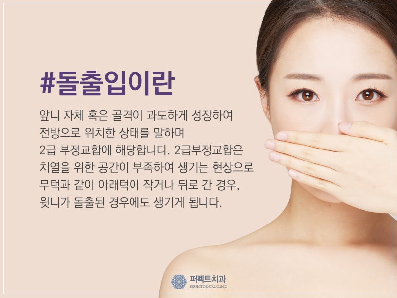[대전교정치과] 서울브라운치과 돌출구 교정으로 웃음 찾기 2