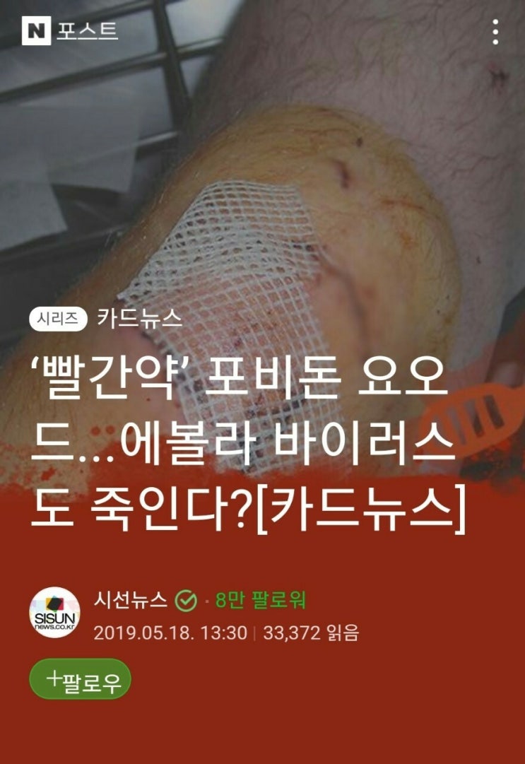 빨간약 포비돈 요오드의 효능