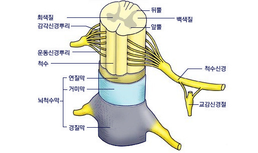 [진단] 척수염과 다발성 경화증