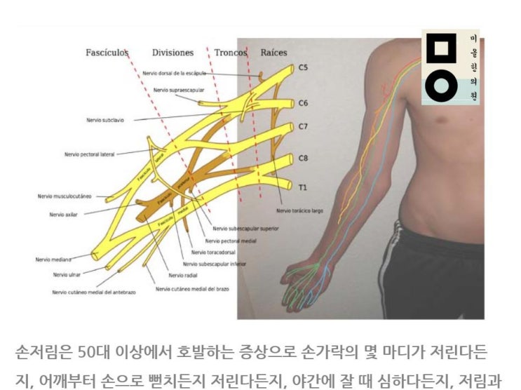 대구손목통증 치료 야간진료