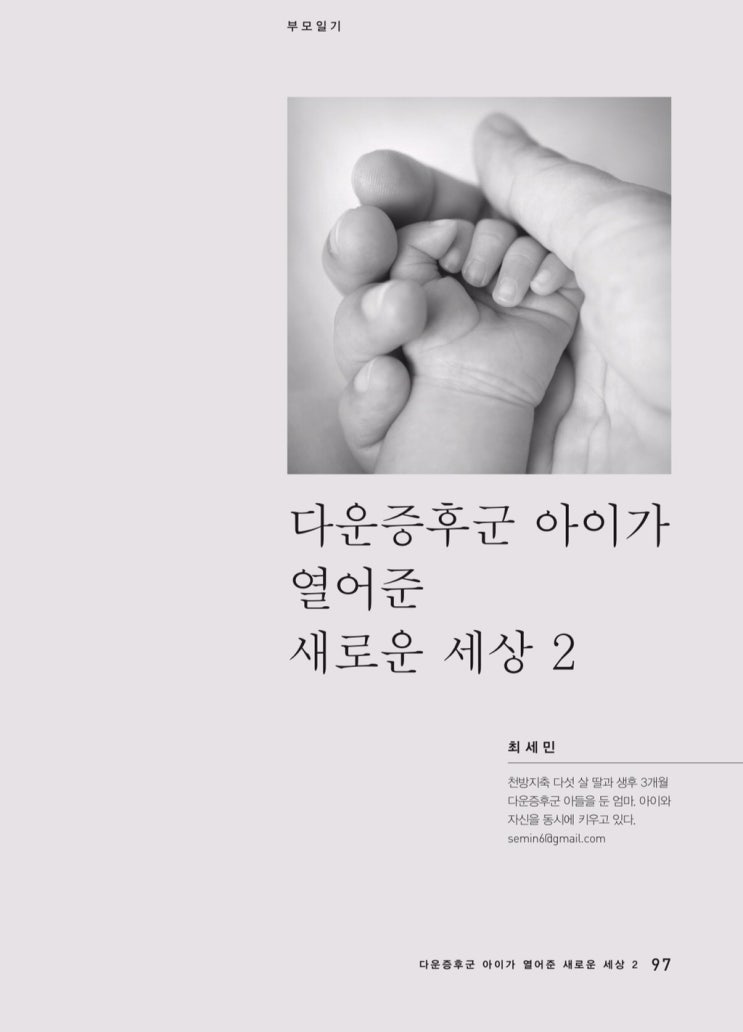  [부모일기] 다운증후군 아이가 열어준 새로운 세상2