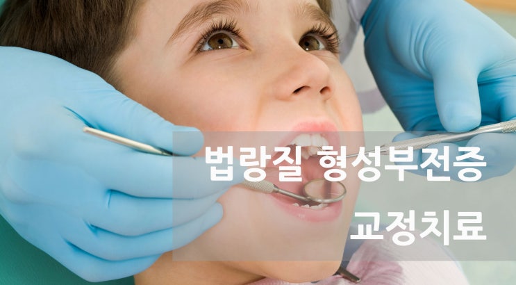법랑질 형성부전증인데 치아교정 가능한가요? 법랑질 형성부전증인데 치아교정 가능한가요?