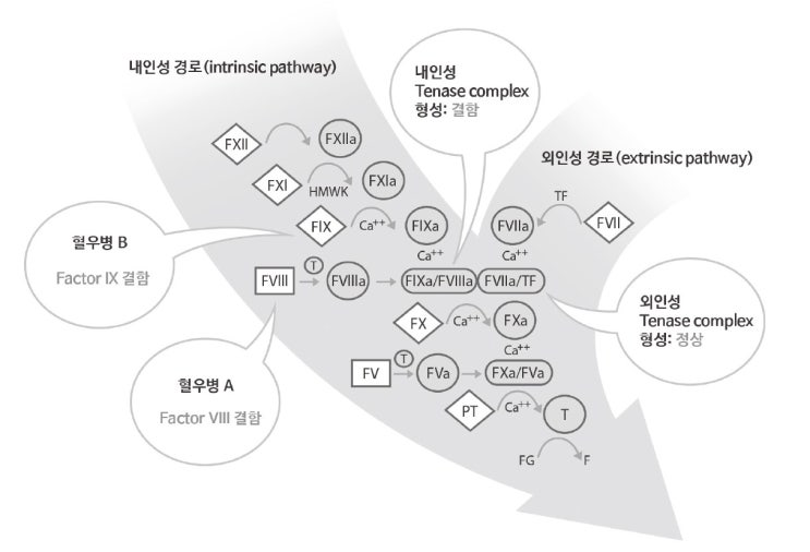 [혈액]  혈우병(Hemophilia) - 개요 / 진단/ 검사소견 알아보기 - 리뷰01.