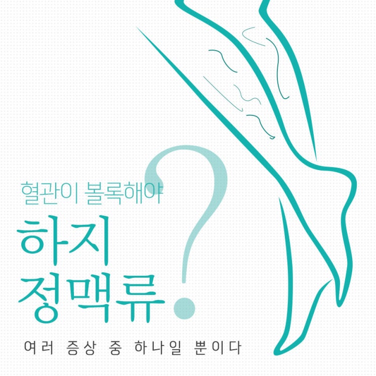 하지정맥류 증상 종아리 통증 외에도 다양, 조기진단/치료 중요