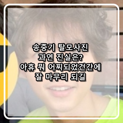  송중기 탈모사진 과연 진실은? 어찌되었건 탈모이던아니던 잘 마무리되길!