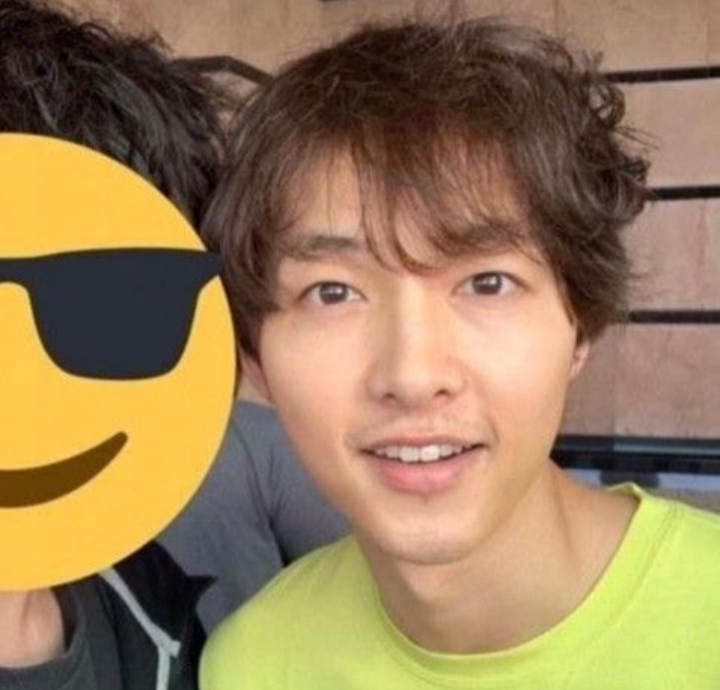  송중기 탈모