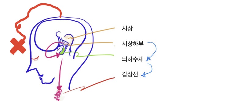  TSH수치 곤두박질, 갑상선 비상1-항암제와 극심한 피곤