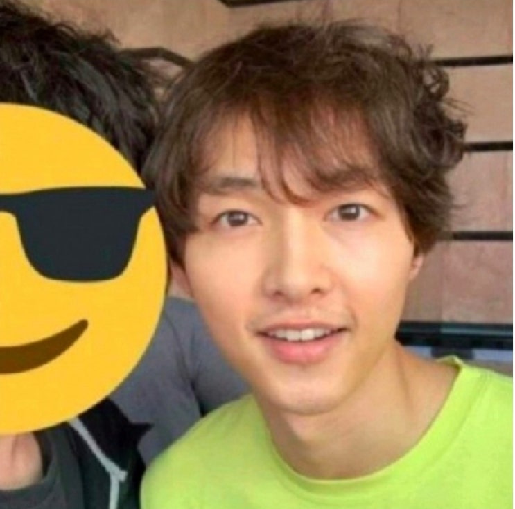  송중기 탈모사진