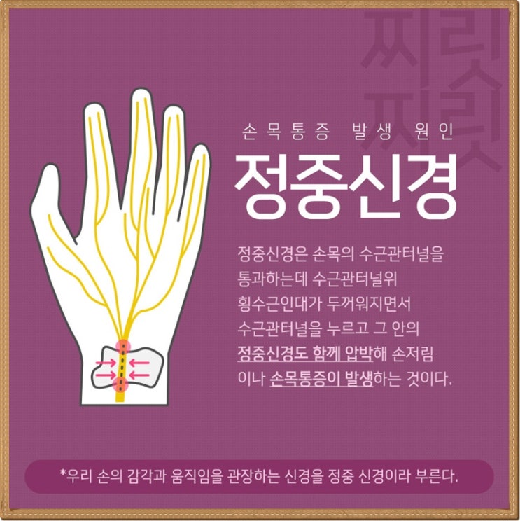  만성손목터널증후군 내시경통해 하루면 해결?