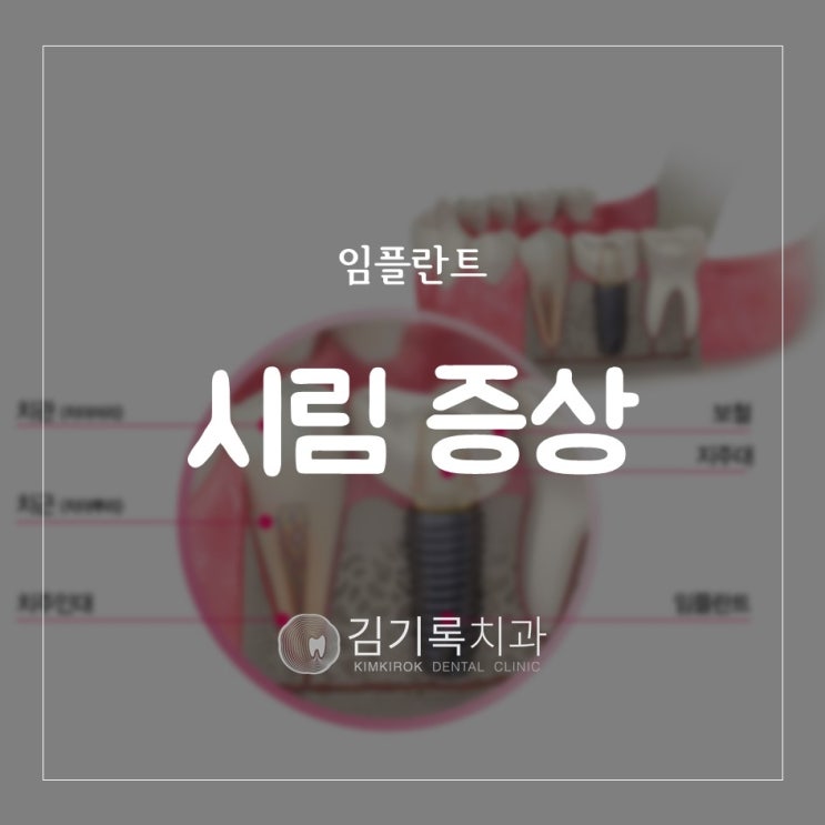 수원치과임플란트 임플란트 후 시려요 임플란트 시릴 수 있나요? 임플란트 후 이 시림 증상