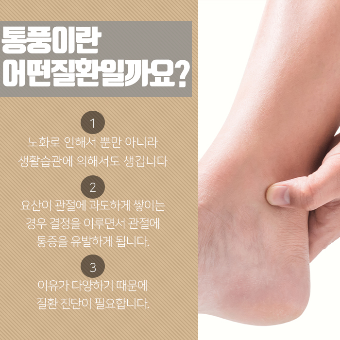 대구통풍치료병원 진단과 관리가 이루어질 수 있게