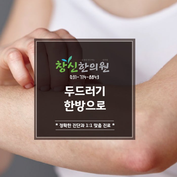 유아 두드러기의 원인과 효과적인 한방치료 3