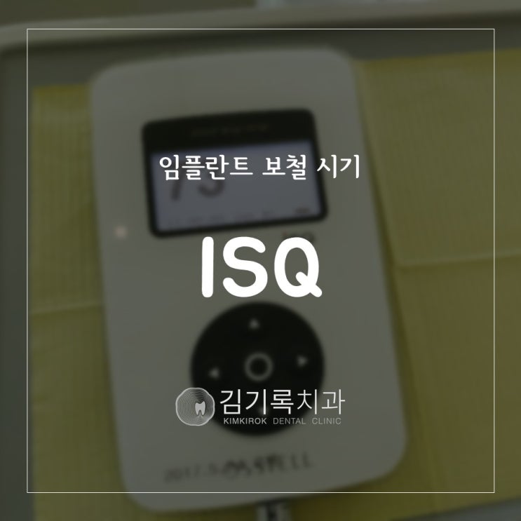 망포임플란트잘하는치과 임플란트 보철은 언제 올라가나요? Osstell ISQ 임플란트 안전도 측정기를 이용한 임플란트 보철 시기 결정