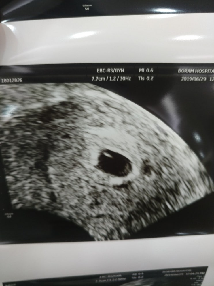 6편 "명랑이"를 만나다. 6편 "명랑이"를 만나다.
