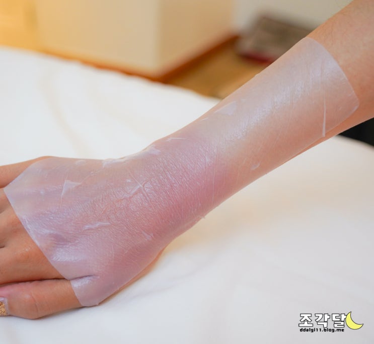  SUNBURN! 해외에서 햇볕 화상 입었다면 TPO 선번멀티패치로 긴급진정하기