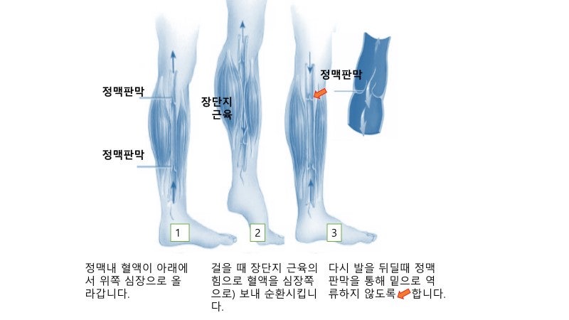 혈액순환 불량 증상 다리부종 원인 마인드폴 포뮬러 선택! 3