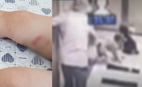  폭스테리어에 물려 끌려간 4살 여아…불쌍해서 입마개 안 했다는 견주, 견권보다 인원을 챙겨야할때