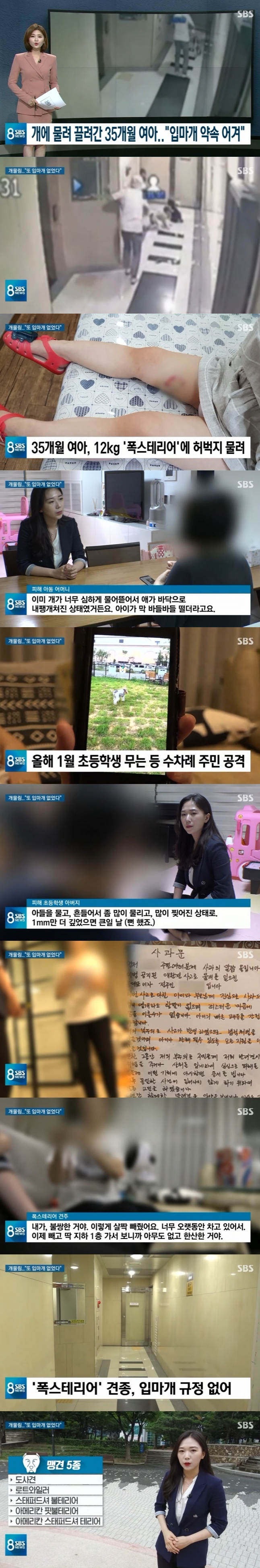  [사건사고]폭스테리어 아이를 사냥할것..35개월 아이를 공격한 개 , 불쌍해서 입마개를 풀었다는 견주...