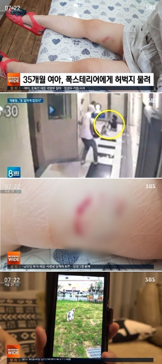  '잘못 키운' 폭스테리어, 아동 성기부터 3살 여아 다리까지 어린 애들만 공격