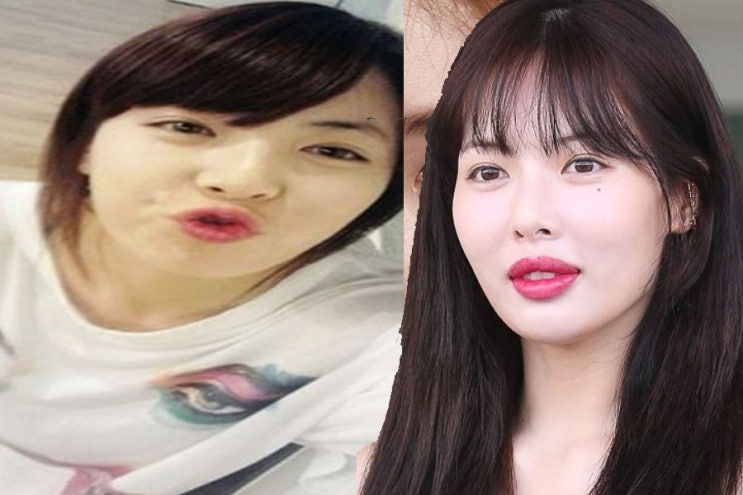 현아 입술 성형 과거사진 비교 (ft.움짤) 현아 입술 성형 과거사진 비교 (ft.움짤)