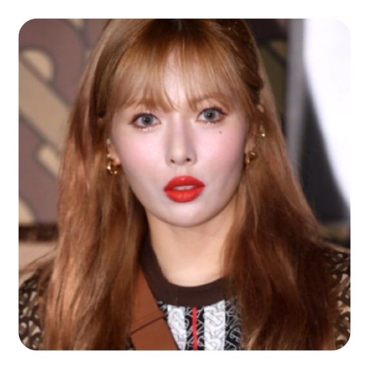  현아 입술 사진 어떻길래? 수술 의혹까지