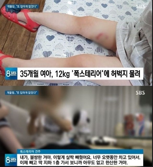  용인 폭스테리어 사건을 보며.. :: 목줄안한 개.