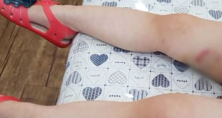 폭스테리어 생각보다 심각. 폭스테리어 생각보다 심각.