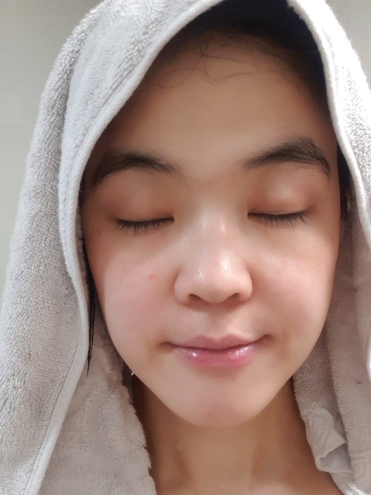  옥길동피부과/삼성새봄피부과 2차레이져 후기 / 위큐어 히알루론산 앰플 사용후기/피부과물광앰플추천/수분감폭발 /난소중해