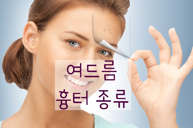  여드름 패인 흉터 종류가 어떤 것들이 있는지 살펴보자