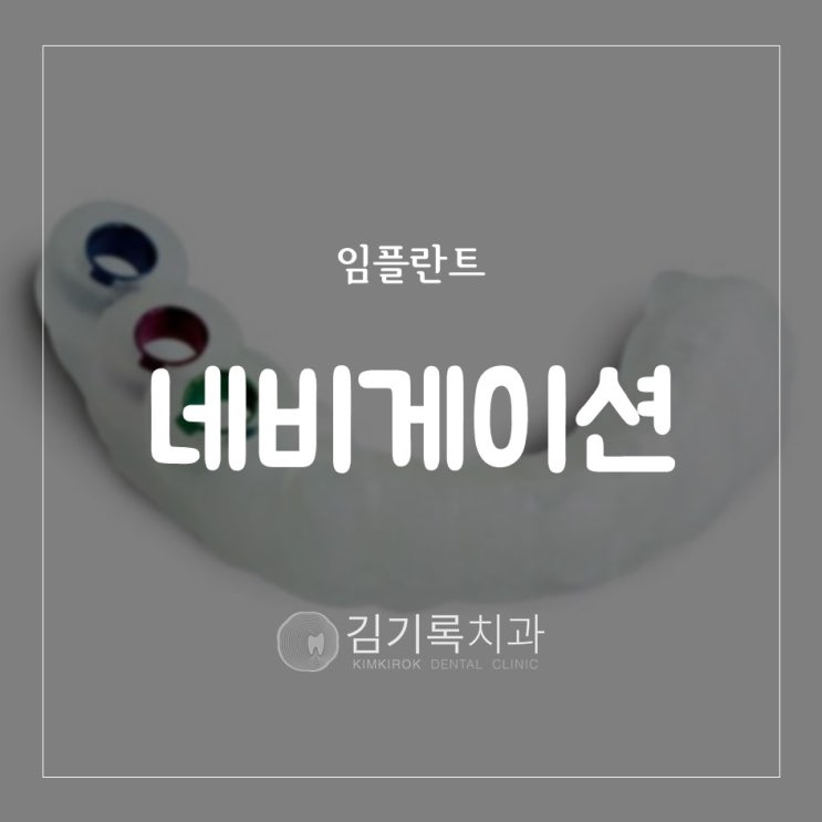 수원임플란트 네비게이션임플란트가 무엇인가요? 일반임플란트와 어떤 점이 다른가요?