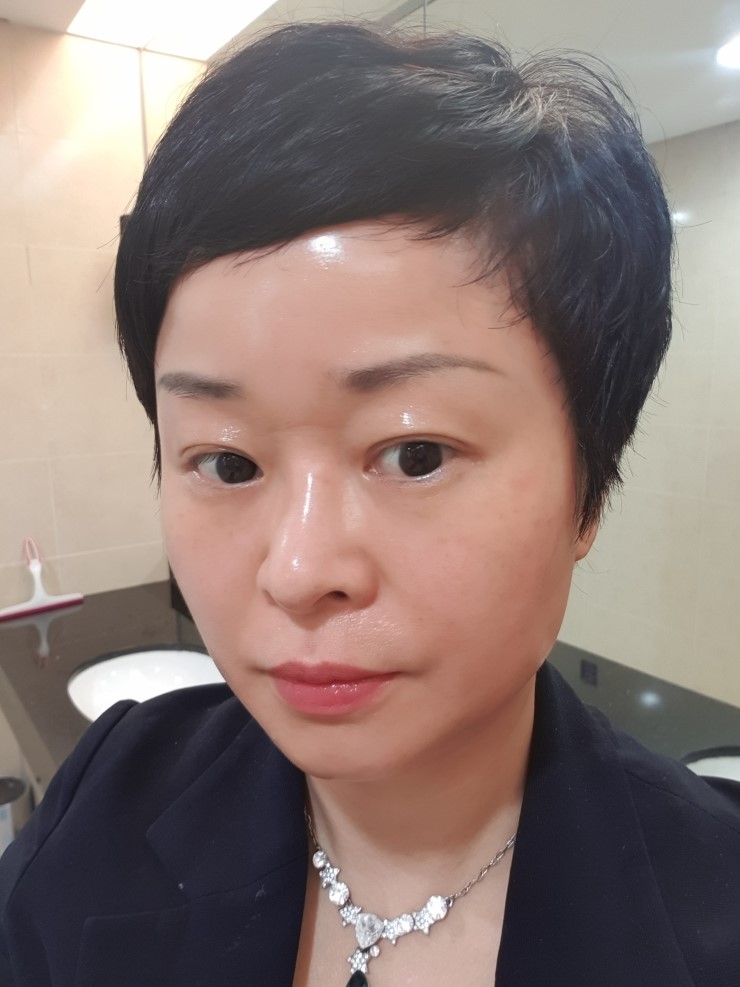  인셀덤 부작용이 아닌 호전반응을 거친 기적적인 사용방법효과(엑티브 크림 후기 김기춘 드림클리닉 홈페이지) 가입및구입방법안내(소개자 홍현령INC00156)