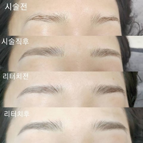  눈썹문신 직후/눈썹문신탈각후/눈썹문신리터치후기 왕십리 눈썹문신 비비네>_<