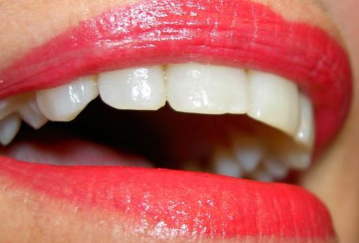 변색이 된 누런 이빨도 전문가 치아미백으로 하얗게 변신이 가능합니다.
