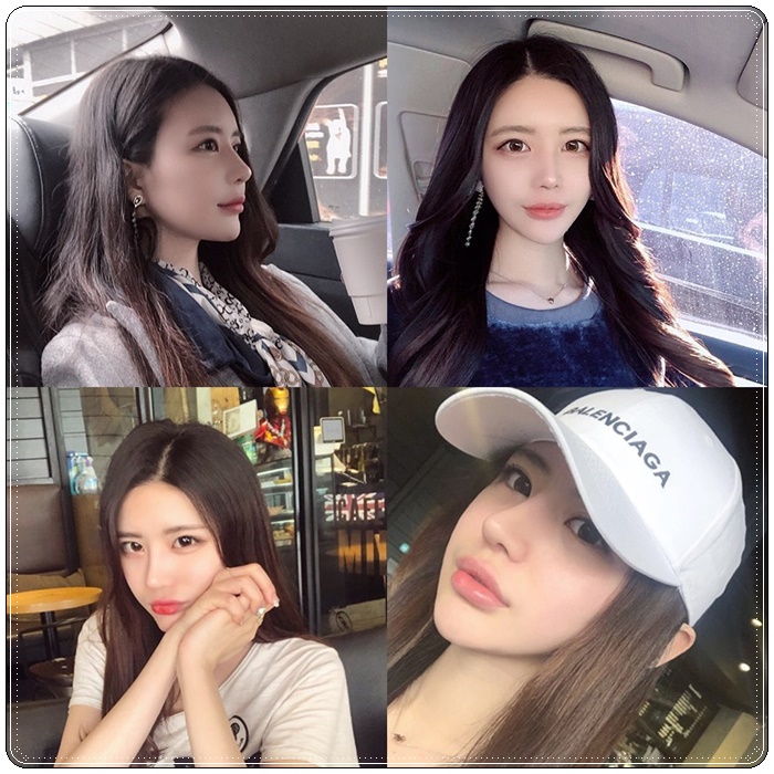  자연유착 쌍꺼풀후기 러블리하게!