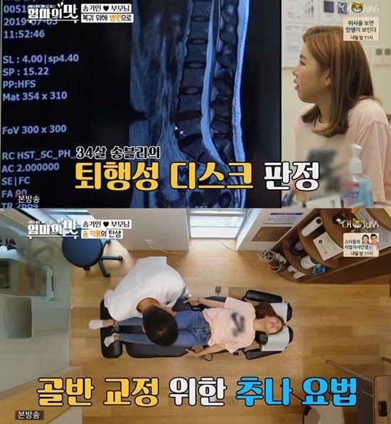  교통사고 후유증으로 '퇴행성 디스크' 판정받은 송가인