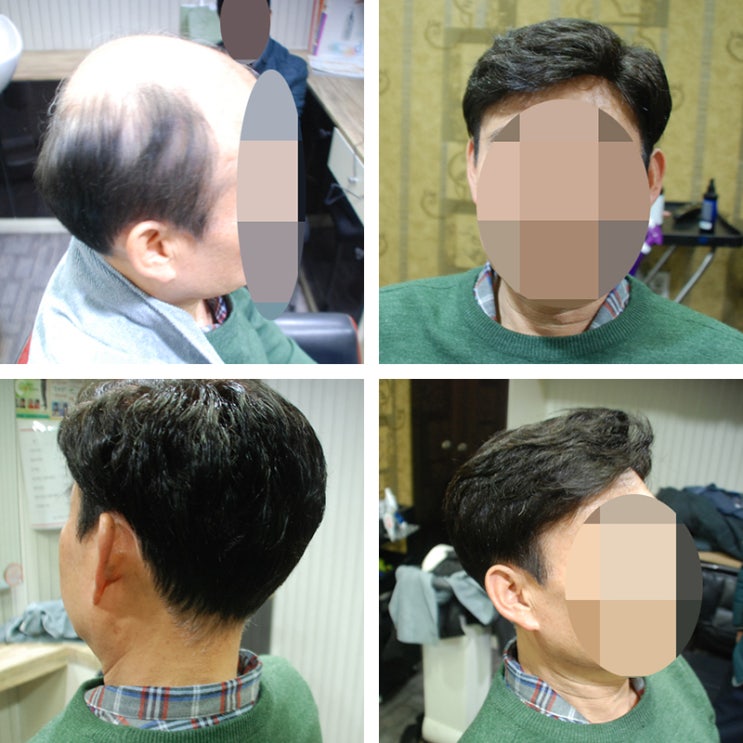  [모위드] 부산 남성가발 맞춤 당일착용가능