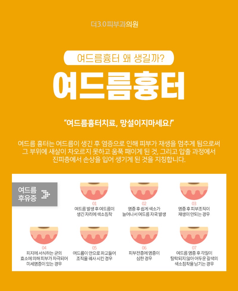 압구정 여드름 치료, 이런 기준으로 병원을 알아보시면 안 됩니다.
