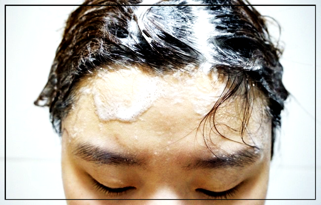  두피스케일링 깨끗하고 가려움 각질(비듬) 제거