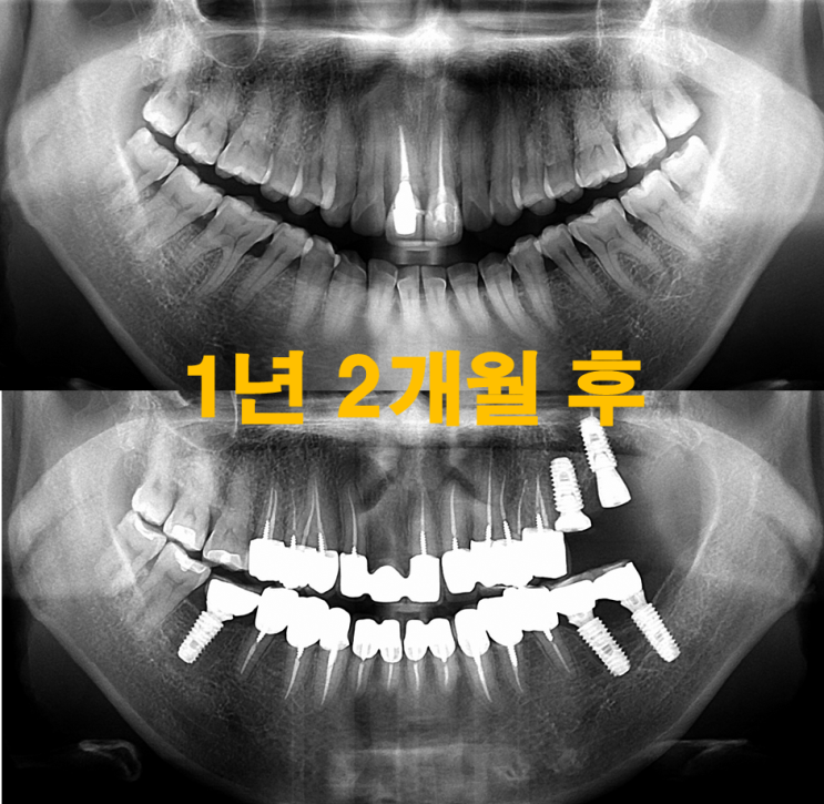  [SBS 궁금한이야기y 공포의 치과의사 인터뷰, 그 후 ]