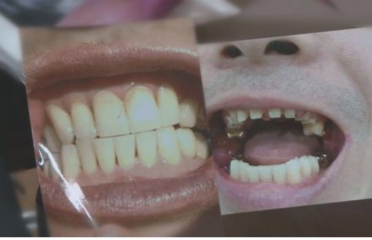 '궁금한 이야기Y’ 양도 받은 치과에서 벌어진 일, 큰 상해 입은 환자가 받는 치료를...