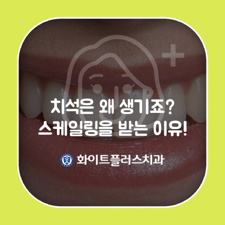  아프고 시린 스켈링(스케일링), 왜 해야할까?
