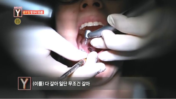 궁금한이야기Y 공포의 치과의원 치아가 모두 갈린 80명 환자, 베트남 여성 폭행