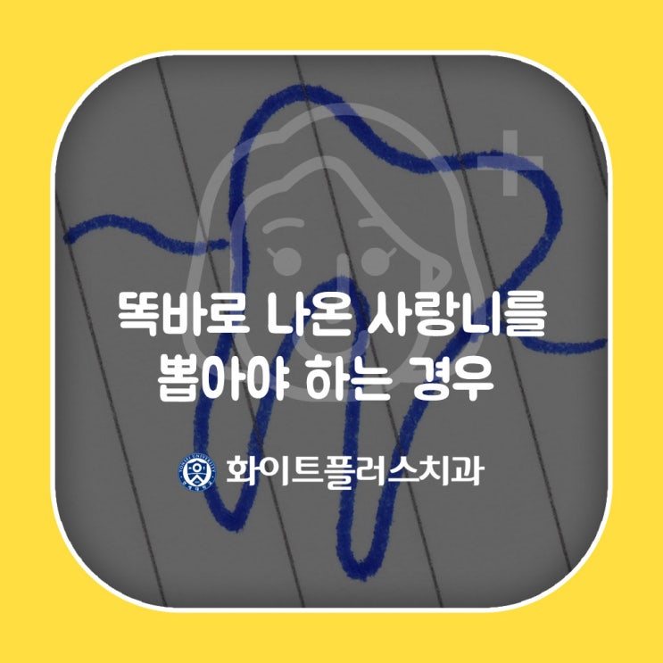  똑바로 나온 사랑니를 뽑아야하는 경우