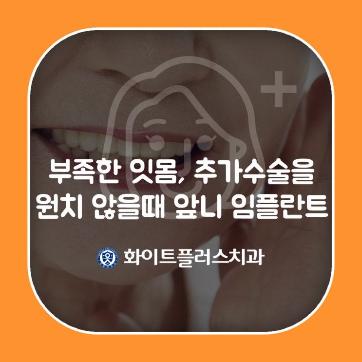  앞니 임플란트 잇몸이 부족하나 추가 수술을 원치 않을때