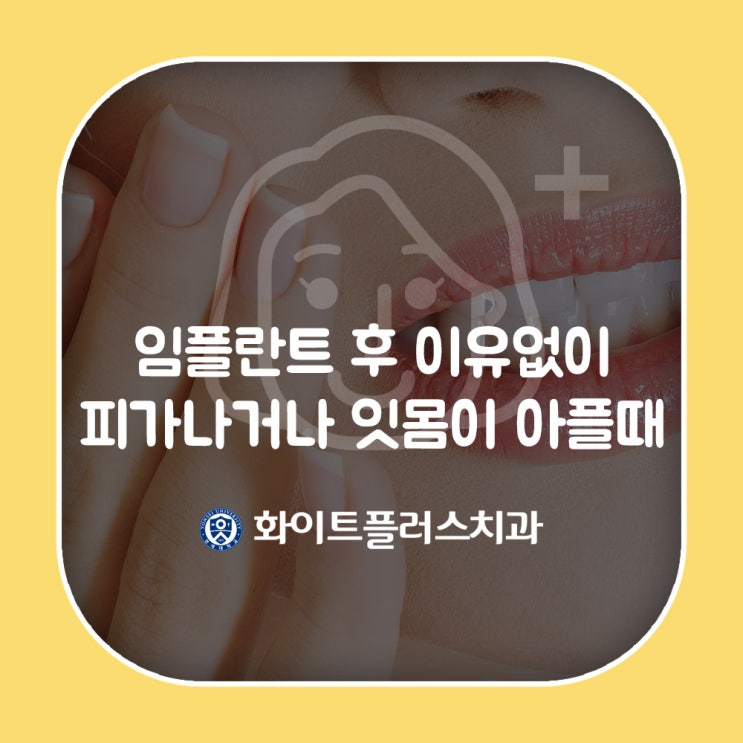  임플란트후 이유없이 피가 나거나 잇몸이 아플때