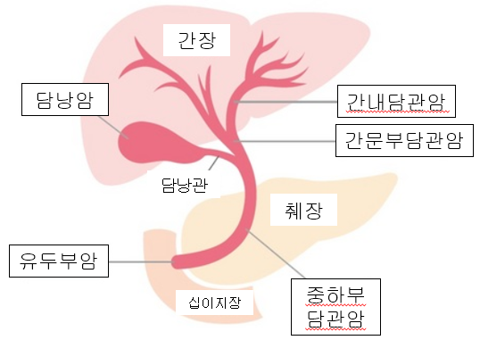 담도암(담관암)의